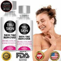 https://buddysupplement.com/tru-skin-tag-remover-review/