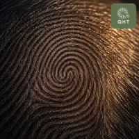Best Hair Transplant in india | QHTClinic