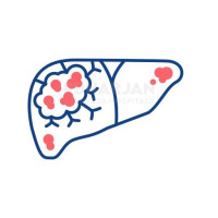 Best Liver Cancer Treatment Hospitals in Chennai