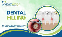 Dental Filling in Dwarka, Delhi | Dentoamigo