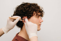 Ear Reshaping Surgery in Riyadh