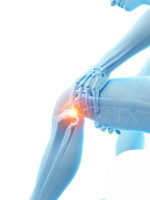 Comfoknee Germany: Advanced Knee Compression Sleeve Benefits
