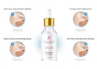 Amarose Skin Tag Remover Reviews Beware Shocking Side Effects & Fake Ingredients! Read Must Before Buy!!