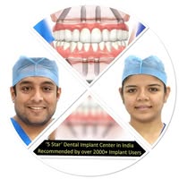Burute Dental - Full mouth Dental Implants Center & Dental clinic