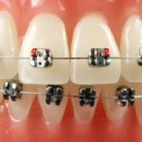 Best Dental Clinic in Kukatpally | V R Dental Maxillofacial