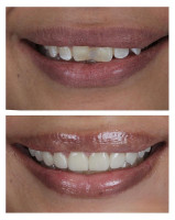 Dental Centre - Dentist in Chattarpur