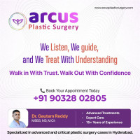 Arcus Plastic Surgery Clinic | Gynecomastia, Plastic & Cosmetic Surgery Clinic in Kukatpally, Hyderabad