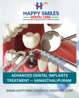 Advanced Dental Implants Treatment — Vanasthalipuram Clinic