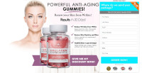 Bellisima Bites Collagen Gummies USA Reviews & Active ingredients [2023]