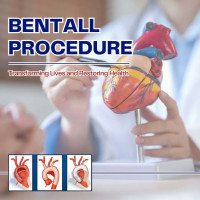 India Cardiac Surgery Site