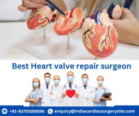 Best Heart valve surgeons India