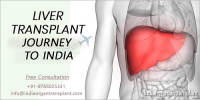 Liver Transplant Surgery in India