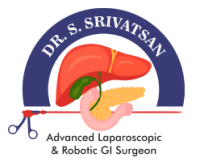 Dr. Srivatsan Gurumurthy - Robotic & Laparoscopic GI Cancer Surgeon | Hernia | Colon, Liver & Pancreatic Diseases Specialist