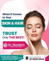 Best Skin Specialist in Peerzadiguda | Hair Loss Treatment in Peerzadiguda