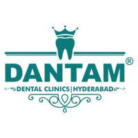 Best Dental Clinic in Gachibowli | Dantam Dental Clinic