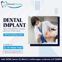 Braces and aligners in Lucknow - Dental Arena