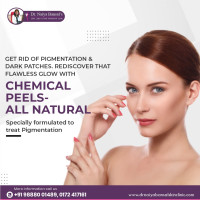 Dr Naiya Bansal - Chemical Peels Treatment in Chandigarh