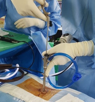 Spine Center in Faridabad Offering Advanced Care for Back, Neck, and Spine Health
