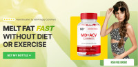 MD+ ACV Gummies New Zealand Reviews [2024]: Know Ingredients & How To Buy?
