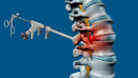 Microscopic Spine Decompression Surgery in Pune | Dr. Rajesh Parasnis