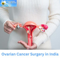 Low Cost Ovarian Cancer Surgery in India