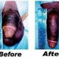 Satisfactory $$ respectable ,27793478685 no side effect *****-creams pills-in Amanzimtoti Cato Ridge Doonside Drummond Durban