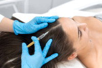 PRP Hair Treatment in Riyadh