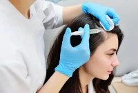 PRP Hair Treatment in Islamabad