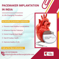 Pacemaker Implantation Surgery India Cost