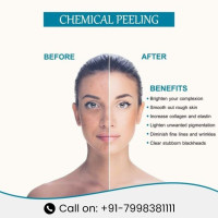 Dr. Gondhane Skin Care Center
