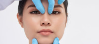 Rhinoplasty surgery in Riyadh