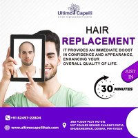 Ultimo hair replacement service