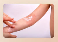 Skin Care Clinic Gurgaon