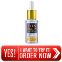 Pros and Cons of Skin Biotix MD Skin Tag