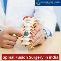 Cost of Spinal Fusion Surgery india