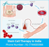 Low Cost Stem Cell Therapy India