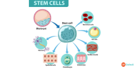 Stem Cell Transplant in India