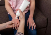 Eczema Rash Treatment