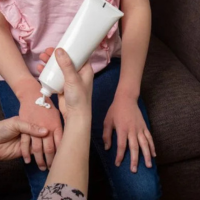 Eczema Rash Treatment