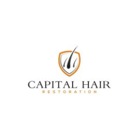 FUE Hair Transplant Clinic London