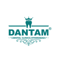 Best and Advanced Dental Clinics in Kondapur