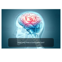 Weathering the Storm: Duration of a Concussion