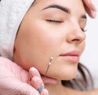 Facial Thread Lifting in Bengaluru Near Me | ZIUR Wellness