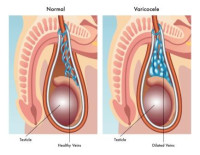 Interventional Radiologist in Pune - Expert IR Clinic