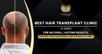 Restore Your Confidence with Advanced Hair Transplant at MedLinks