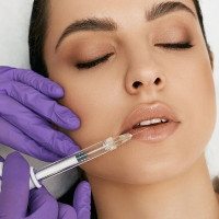 Best lip augmentation treatment in islamabad pakistan