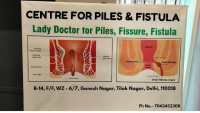 Painless & Advanced Laser Piles Treatment in Tilak nagar