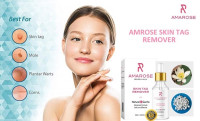 Best Skin Tag And Mole Remover: Most Effective Skin Tag Mole Removal Products