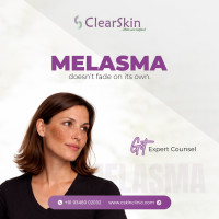 Acne Scar Removal in Madhapur Hyderabad