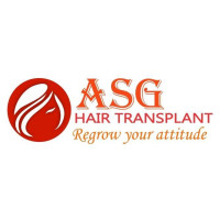 FUE Hair Transplant in India, Punjab